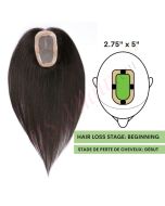 Black / Brown #1b Hair Topper 14 inch For Thinning Hair Part (Size: 2.75 inch x 5 inch, Weight: 45g) Remy Human Hair 