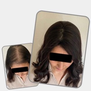 Before and after hair topper